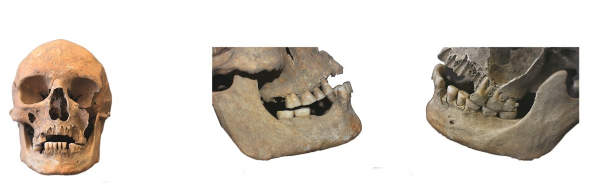 Eines der untersuchten Individuen.