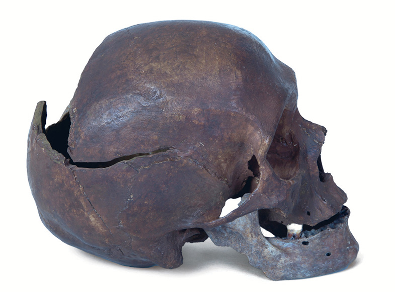 Schädel aus Massengrab am Rande des Landweges mit Spuren von Hieben, die den Tod verursachten.