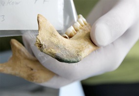 Eine Hand mit Handschuh hält den menschlichen Unterkiefer aus dem Gräberfeld von Sanzkow im Labor bei der Beprobung. Für die Analyse alter DNA sind bei entsprechendem Erhaltungszustand Zähne gut geeignet. 