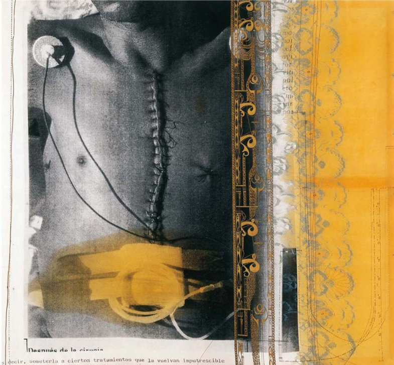 Correcturas Simulativas