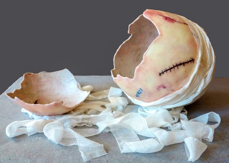 Halb geschundener Leib, halb hoffnungsfrohes Osterei: Die Künstlerin Carola Faller-Barris hat mit Entbindung ein vielschichtiges Werk geschaffen.  (Foto: Carola Faller-Barris)