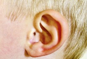 Das Ohr eines Kindes. 