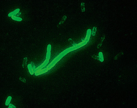 Grünes Bakterium in Nahaufnahme unter dem Mikroskop