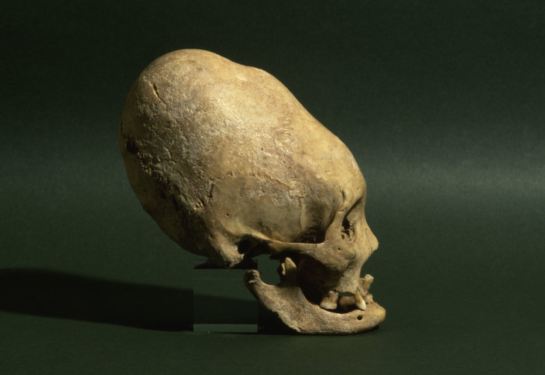 Mittels Bandagen wurden die Schädel so lang. Das galt den Hunnen als chic.