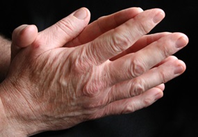 Gefaltete Hände eines älteren Menschen