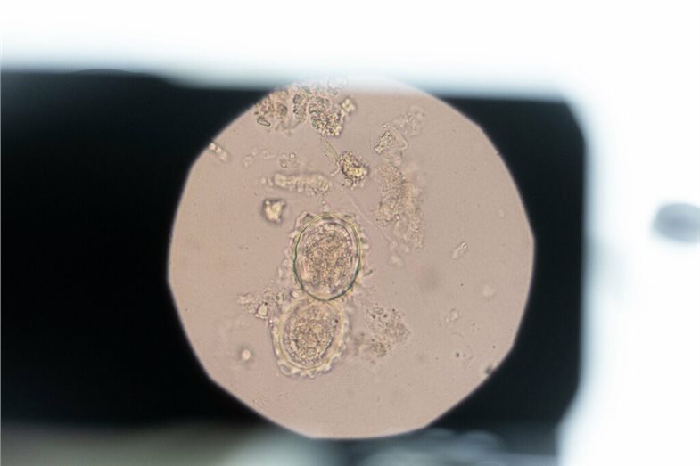 Darmparasiten Hallstatt Detail einer Probe