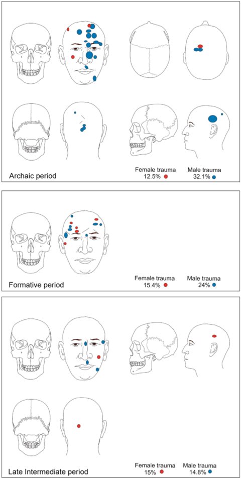 Zeichnung mit Prozentangaben zu der Verteilung geheilter Schädelverletzungen 