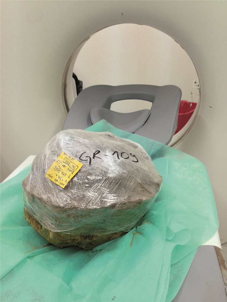 Daher wurden die Urnen intakt und samt Füllung geborgen und für weitere Untersuchungen nach Zagreb gebracht.