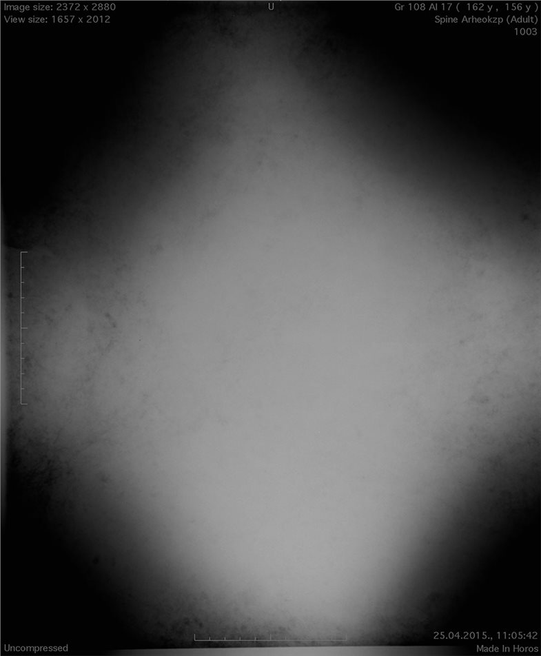 Konventionelle Röntgenaufnahmen ergaben jedoch kein brauchbares Bild.