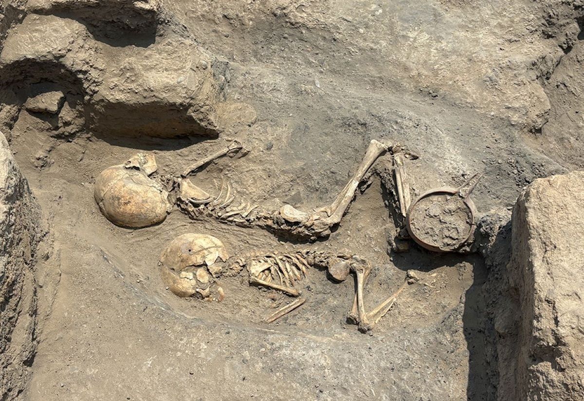 Frühbronzezeitliche Neurochirurgie: Trepanation bei einem Kind in Djarkutan, Usbekistan nachgewiesen