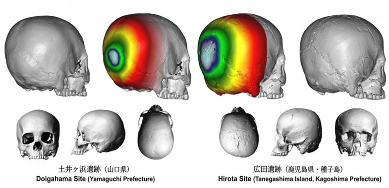 3D-Bilder der Schädel aus dem Doigahama-Fundort (links) und dem Hirota-Fundort (rechts). 3D-Bilder von Schädeln aus der Hirota-Fundstelle und der Doigahama-Fundstelle, die die Forscher zum Vergleich der Schädelmorphologie der beiden Gruppen verwendeten. Beachten Sie, dass der Schädel aus der Hirota-Fundstelle (rechts) im Vergleich zu den Schädeln aus der Doigahama-Fundstelle (links) einen abgeflachten Hinterkopf aufweist, was auf eine absichtliche Schädelveränderung hindeutet. Foto: Seguchi Labor / Kyushu Universität
