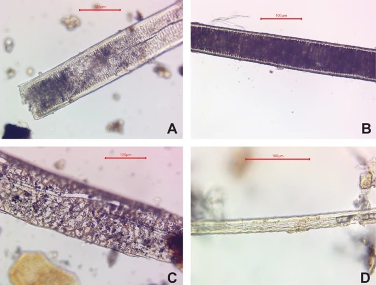 Vier mikroskopische Aufnahmen von Fasern mit unterschiedlichen Strukturen und Texturen, jeweils mit Maßstab von 100 Mikrometern
