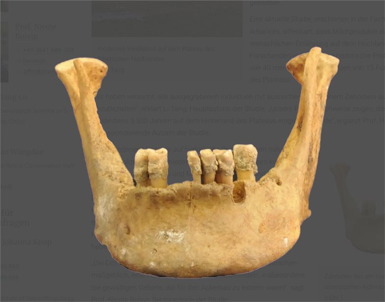 Zahnstein des am höchsten gelegenen untersuchten Individuums der Studie (vor 601-758 n.Chr.). 